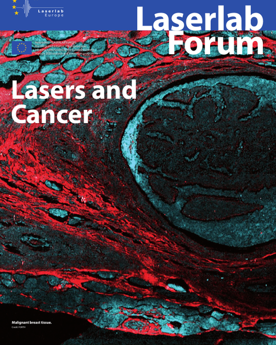 Laserlab-Europe Newsletter #29: Lasers and Cancer